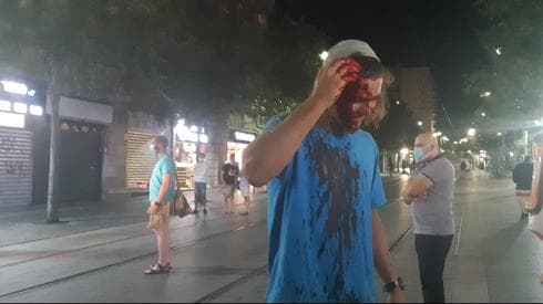 אחד מפעילי להב״ה החשודים בתקיפה אחד מפעילי להב״ה החשודים בתקיפה