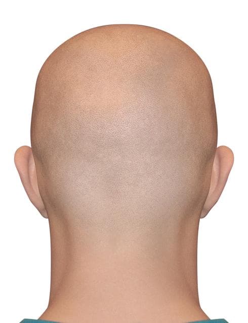 תובע פיצוי תובע פיצוי