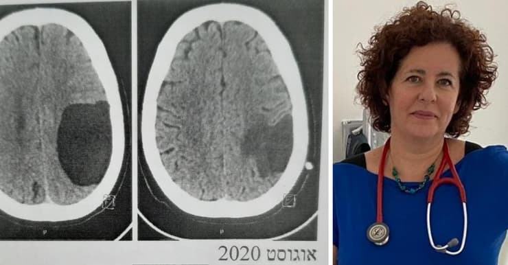 ד"ר שרון שמואלי וצילום הסי-טי