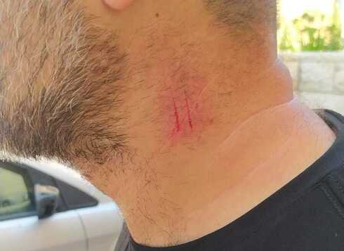 אחד המתנדבים שהותקף
