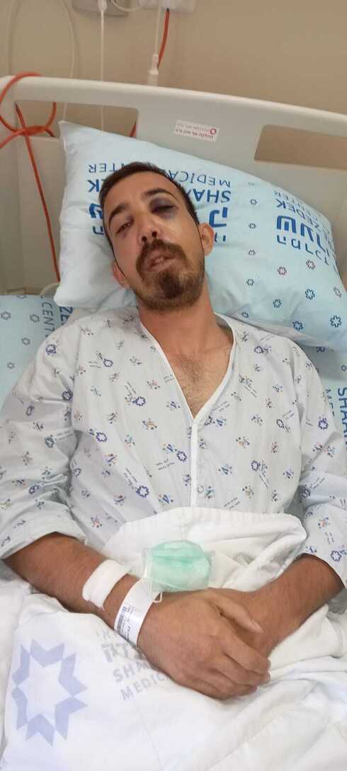 מארק אידן בבית החולים שערי צדק