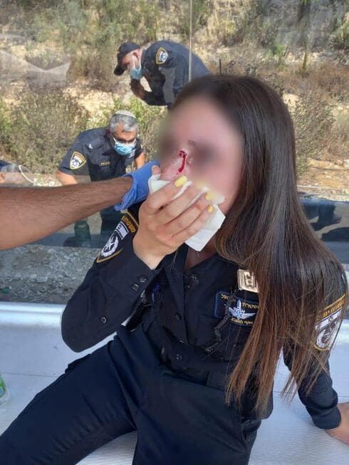 אחת מהשוטרות שהותקפו