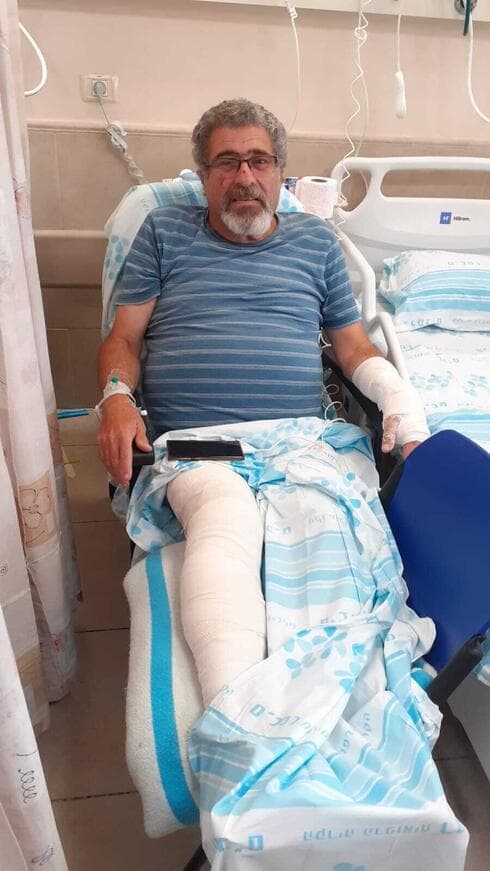 נפגע תקיפת חזיר הבר