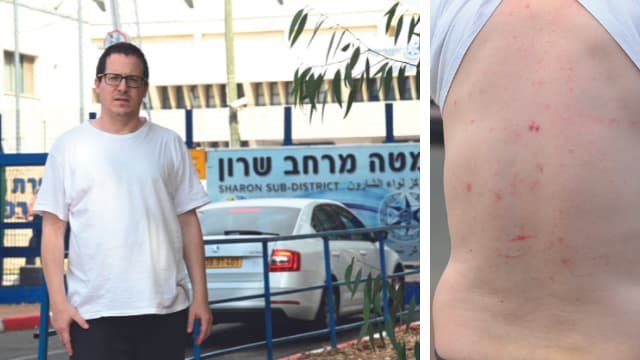 אסף פרי. "גרמו לי חבלות"