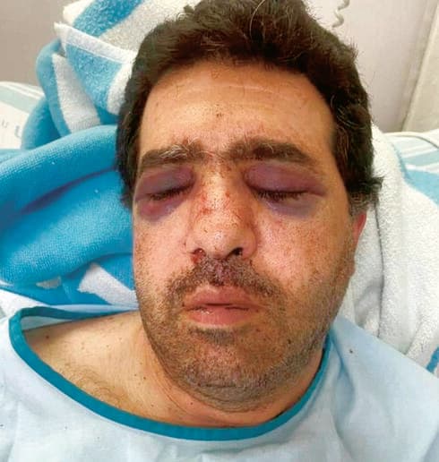 בני סלמן. אז