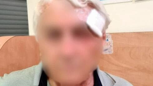 יוסי לאחר התקיפה. איבד דם רב יוסי לאחר התקיפה. איבד דם רב