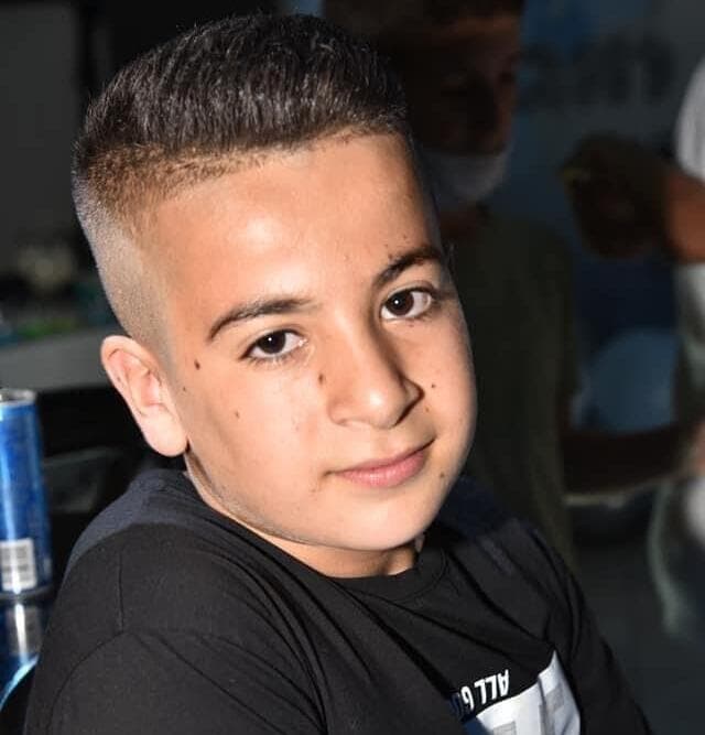 אביאל דבוש, מאושפז עם כוויות בכל גופו