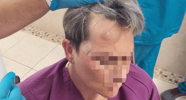 סימני האלימות על מצחה של הסייעת שהותקפה