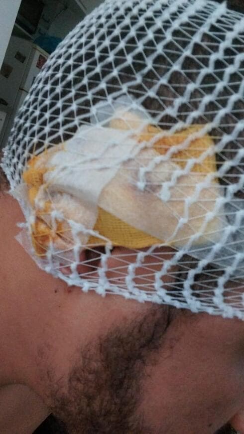 הפציעה של ראש מערך האבטחה במועדון המאיו