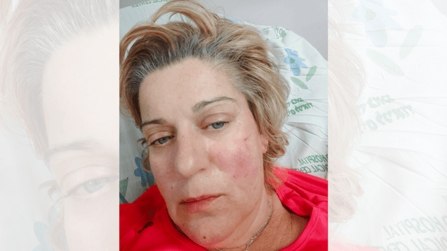 טטיאנה בבית החולים, אחרי התקיפה