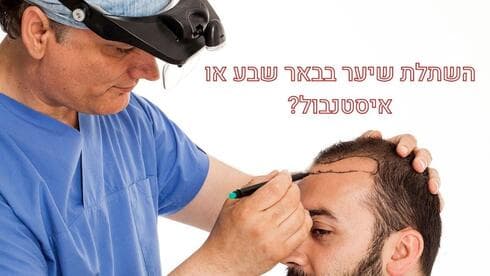 השתלת שיער