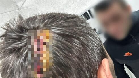 הותקף במוט ברזל