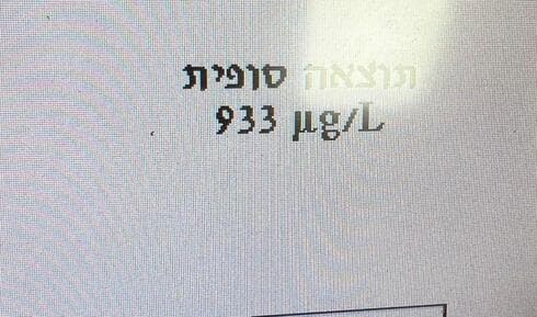 פי שלושה מהמותר בחוק