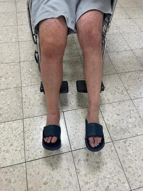 שגיא גלנץ בבית החולים