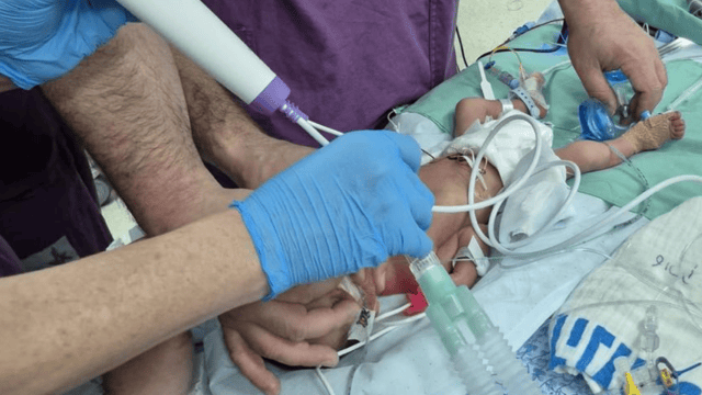 הניתוח בבני ציון