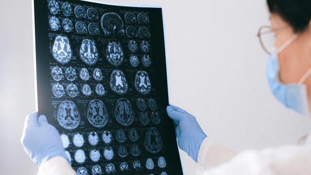 בדיקות MRI מעכשיו בסמי עופר