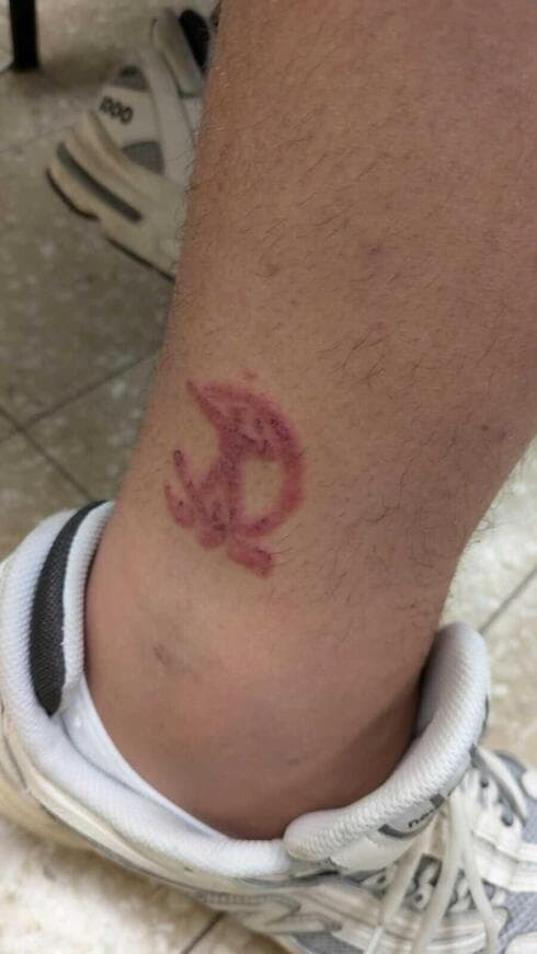 קעקועי חינה מסוכנים