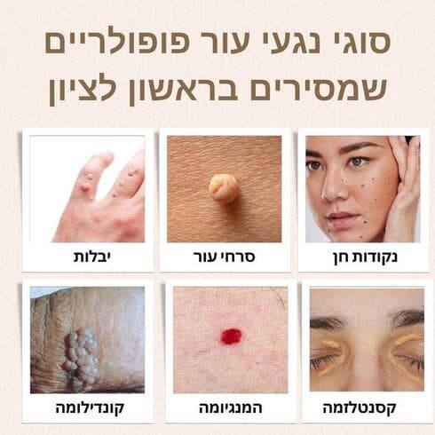סוגי נגעי עור (צילום: יח"צ) סוגי נגעי עור