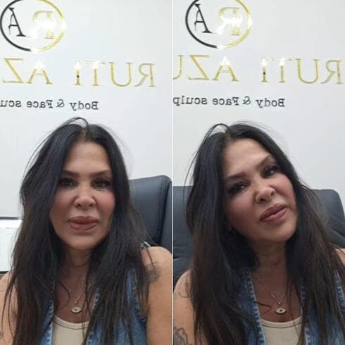 הקליניקה של רותי אזולאי 