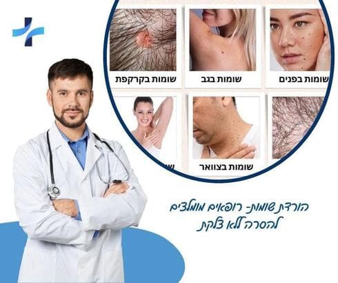 הורדת שומות הורדת שומות