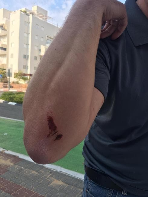 סימני האלימות ליד הקלפי | צילום: פרטי