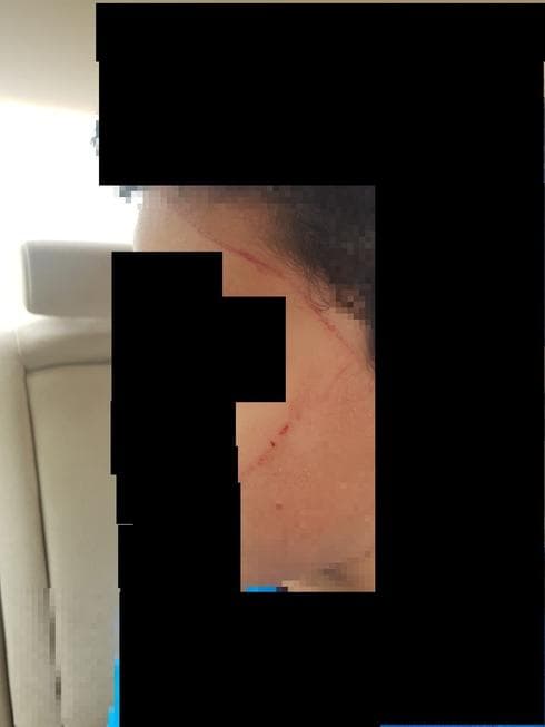 השריטות על פניו של התלמיד. צילום: באדיבות אמו של הילד