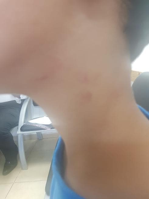 צילום: באדיבות אמו של הילד