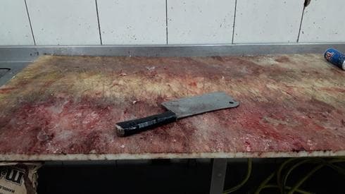 הביקורת באטליז. צילום: דוברות משרד הבריאות
