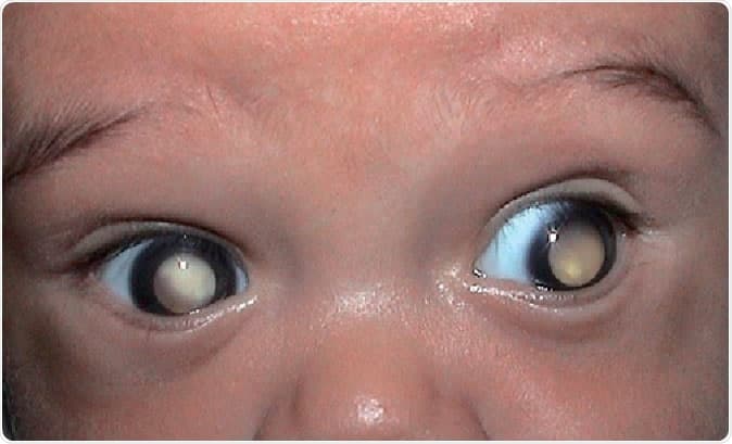 Ojos
