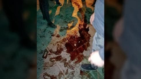 Sangre en las calles de Teherán durante el homenaje a las víctimas del avión ucraniano derribado por Irán (AP) Homenaje a las Sangre en las calles de Teheránvíctimas del avión ucraniano derribado por Irán