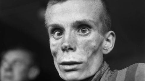 Esta foto de archivo tomada el 1° de mayo de 1945 muestra a un judío ruso no identificado de 18 años en el campo de concentración de Dachau que sufre de disentería (AFP) Fotos Shoá