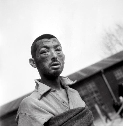 Un prisionero torturado en el campo de concentración de Buchenwald en abril de 1945
(AFP) Fotos Shoá
