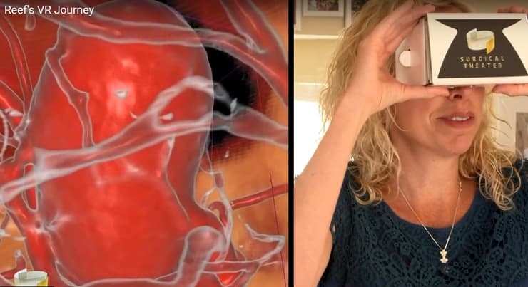La madre de Reef mira imágenes en 3D dentro del cráneo de su bebé gracias a la plataforma Surgical Theatre 