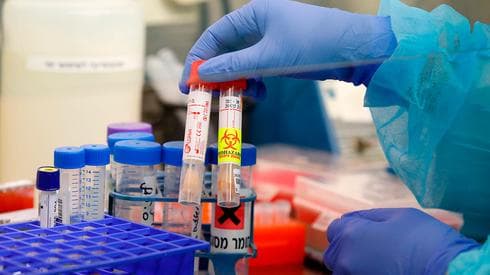 Kits de prueba de coronavirus en el Hospital Ichilov en Tel Aviv. 