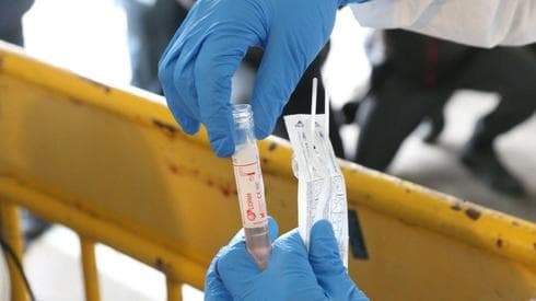 Pruebas rápidas de coronavirus