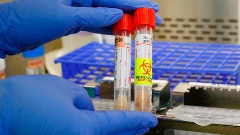 Investigación sobre coronavirus en el Hospital Ichilov de Tel Aviv. 