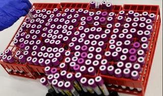 Pruebas de coronavirus en Ashkelon.