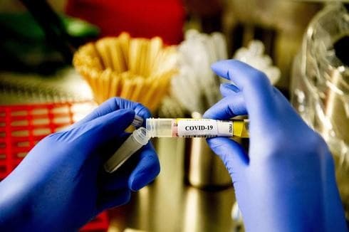 Prueba de coronavirus.