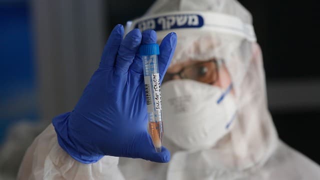 Fuerte incremento en la tasa de positividad en las pruebas de coronavirus realizadas en Israel. (AFP) Fuerte incremento en la tasa de positividad en las pruebas de coronavirus realizadas en Israel.