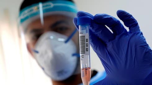 Un trabajador de un laboratorio israelí realiza una prueba para detectar COVID-19. (AFP) Un trabajador de un laboratorio israelí realiza una prueba para detectar COVID-19.