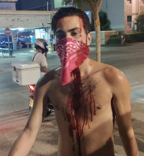 Uno de los manifestantes heridos en la protesta.