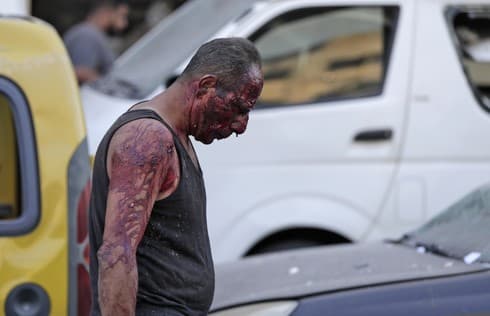 Hombre cubierto de sangre camina por las calles de Beirut luego de la explosión. (AFP) Hombre cubierto de sangre camina por las calles de Beirut luego de la explosión.