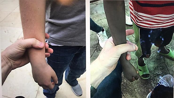 Las personas en el campamento sufren de desnutrición.