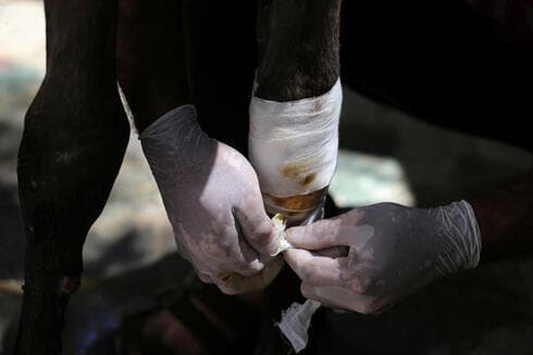 Un hombre trata a un caballo que resultó herido durante los combates entre israelíes y palestinos, en el norte de la Franja de Gaza. 