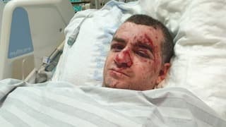 Edward Weinstock tras resultar herido por el impacto de un misil en su apartamento de Ashkelon.