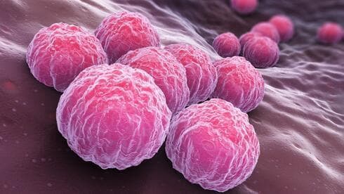 La bacteria de la clamidia. 