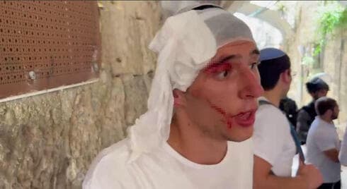 Enfrentamientos en la Ciudad Vieja - niño judío herido.
