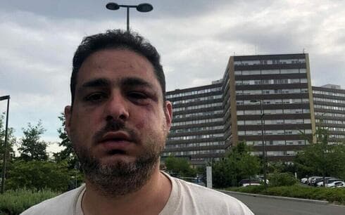 Audrey Rozenhaft subió una foto de su marido Liron después de ser golpeado en Estrasburgo, Francia, el 2 de junio de 2022. 