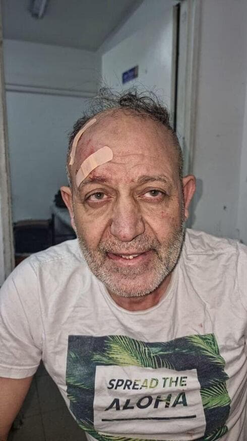 Basam al-Saadi, líder en Cisjordania de la Yihad Islámica, después de su arresto. 