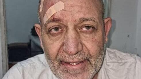Basam al-Saadi, líder en Cisjordania de la Yihad Islámica, después de su arresto. 